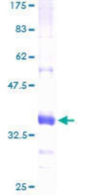 SDS-PAGE: Recombinant Human Chitobiase/CTBS GST (N-Term) Protein [H00001486-P01]