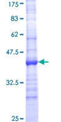 SDS-PAGE: Recombinant Human CYP24A1 GST (N-Term) Protein [H00001591-Q01]