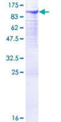 SDS-PAGE: Recombinant Human DGK-alpha GST (N-Term) Protein [H00001606-P02]