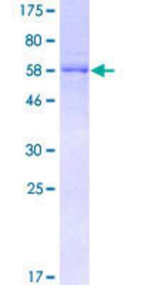 SDS-PAGE: Recombinant Human DOCK2 GST (N-Term) Protein [H00001794-P01]