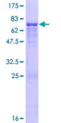 SDS-PAGE: Recombinant Human ENO1P GST (N-Term) Protein [H00002025-P01]