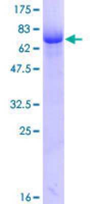 SDS-PAGE: Recombinant Human Dematin GST (N-Term) Protein [H00002039-P01]