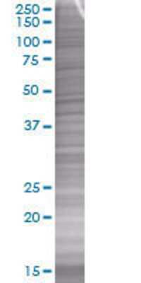 Other: Coagulation Factor III/Tissue Factor 293T Cell Transient Overexpression Lysate [H00002152-T01]