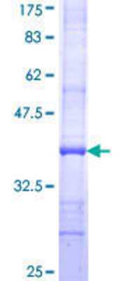 SDS-PAGE: Recombinant Human Factor VIII GST (N-Term) Protein [H00002157-Q01]
