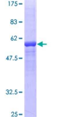 SDS-PAGE: Recombinant Human Factor XII heavy chain GST (N-Term) Protein [H00002161-P01]