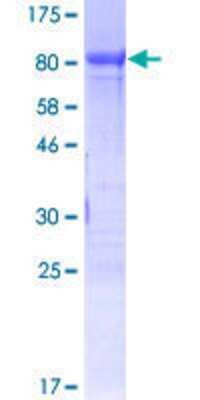 SDS-PAGE: Recombinant Human FoxC2 GST (N-Term) Protein [H00002303-P01]