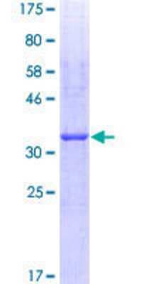 SDS-PAGE: Recombinant Human Hyaluronan synthase 2 GST (N-Term) Protein [H00003037-Q01]
