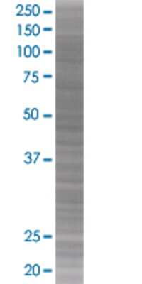 Other: HIF-1 alpha 293T Cell Transient Overexpression Lysate [H00003091-T01]