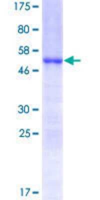 SDS-PAGE: Recombinant Human HOXC6 GST (N-Term) Protein [H00003223-P01]