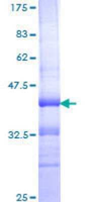 SDS-PAGE: Recombinant Human Integrin alpha 4/CD49d GST (N-Term) Protein [H00003676-Q01]