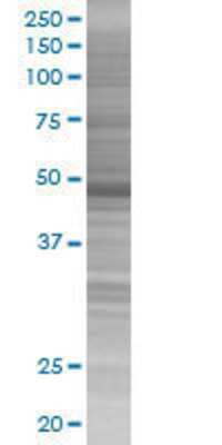 Other: Cytokeratin 17 293T Cell Transient Overexpression Lysate [H00003872-T01]