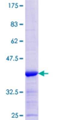 SDS-PAGE: Recombinant Human LAD1 GST (N-Term) Protein [H00003898-Q01]