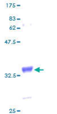 SDS-PAGE: Recombinant Human Metallothionein-1H GST (N-Term) Protein [H00004496-P01]