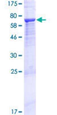 SDS-PAGE: Recombinant Human Myosin-Id GST (N-Term) Protein [H00004642-P01]
