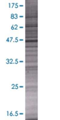 Other: Myosin-Id 293T Cell Transient Overexpression Lysate [H00004642-T01]