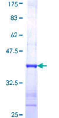 SDS-PAGE: Recombinant Human iNOS GST (N-Term) Protein [H00004843-Q01]