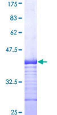 SDS-PAGE: Recombinant Human NRAMP2/SLC11A2/DMT1 GST (N-Term) Protein [H00004891-Q01]