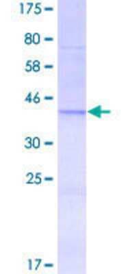 SDS-PAGE: Recombinant Human PIK3C2A GST (N-Term) Protein [H00005286-Q01]