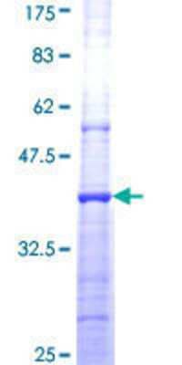 SDS-PAGE: Recombinant Human Phospholipase D2 GST (N-Term) Protein [H00005338-Q01]