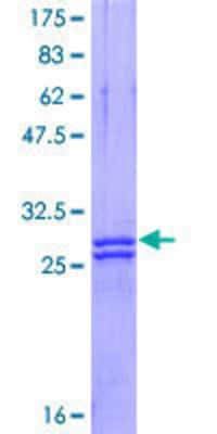 SDS-PAGE: Recombinant Human Myelin PLP GST (N-Term) Protein [H00005354-Q01]