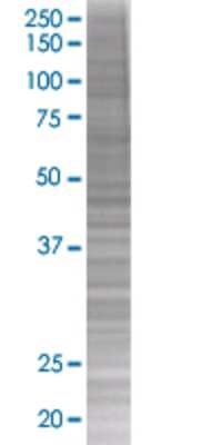 Other: CXCL7/NAP-2 293T Cell Transient Overexpression Lysate [H00005473-T01]