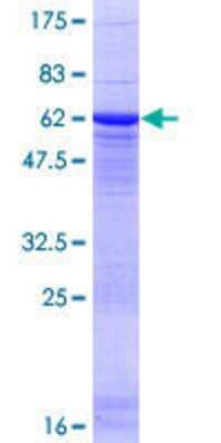 SDS-PAGE: Recombinant Human PP2A alpha GST (N-Term) Protein [H00005515-P01]