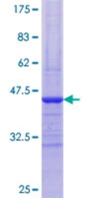 SDS-PAGE: Recombinant Human Glycogen phosphorylase, muscle form GST (N-Term) Protein [H00005837-Q01]