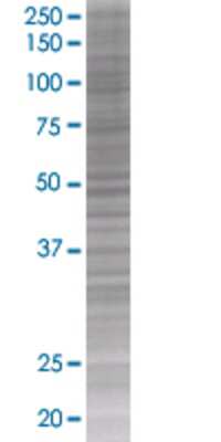 Other: RBBP6 293T Cell Transient Overexpression Lysate [H00005930-T01]