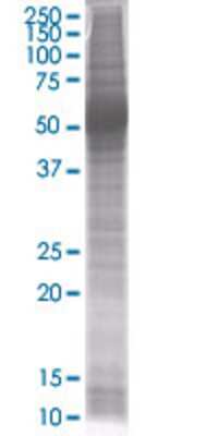 Other: S100A8 293T Cell Transient Overexpression Lysate [H00006279-T01]