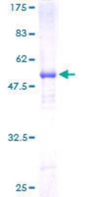 SDS-PAGE: Recombinant Human Scn2b GST (N-Term) Protein [H00006327-P01]