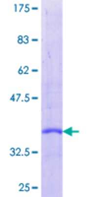 SDS-PAGE: Recombinant Human Secretin GST (N-Term) Protein [H00006343-P01]