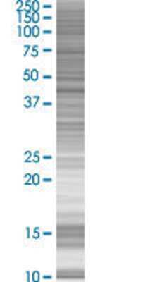 Other: SETMAR 293T Cell Transient Overexpression Lysate [H00006419-T01]