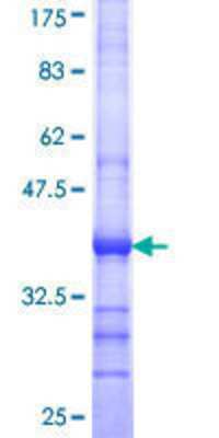 SDS-PAGE: Recombinant Human SKIV2L GST (N-Term) Protein [H00006499-Q01]