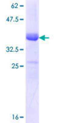 SDS-PAGE: Recombinant Human NKCC1/SLC12A2 GST (N-Term) Protein [H00006558-Q01]