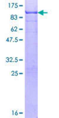 SDS-PAGE: Recombinant Human SOX9 GST (N-Term) Protein [H00006662-P01]