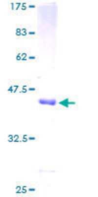 SDS-PAGE: Recombinant Human LOK GST (N-Term) Protein [H00006793-P01]