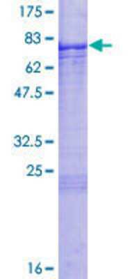 SDS-PAGE: Recombinant Human TBX6 GST (N-Term) Protein [H00006911-P01]