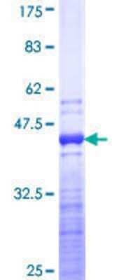 SDS-PAGE: Recombinant Human Troponin T Type 3 (fast skeletal) GST (N-Term) Protein [H00007140-Q01]