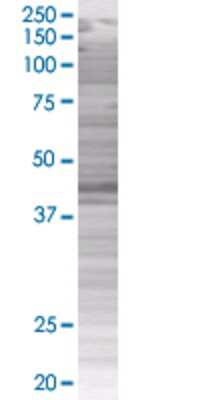 Other: Tensin 1 293T Cell Transient Overexpression Lysate [H00007145-T01]