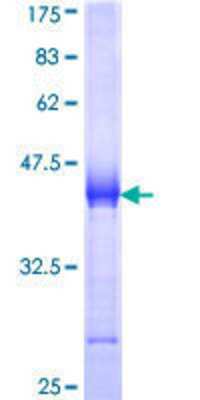 SDS-PAGE: Recombinant Human Utrophin GST (N-Term) Protein [H00007402-Q01]