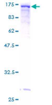SDS-PAGE: Recombinant Human Vinculin GST (N-Term) Protein [H00007414-P01]