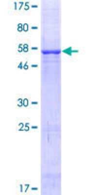 SDS-PAGE: Recombinant Human VDAC3 GST (N-Term) Protein [H00007419-P01]