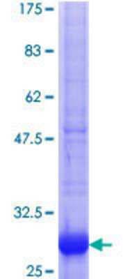 SDS-PAGE: Recombinant Human Annexin A9 GST (N-Term) Protein [H00008416-Q01]