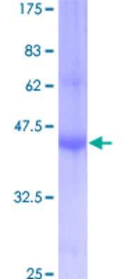SDS-PAGE: Recombinant Human IFITM1 GST (N-Term) Protein [H00008519-P01]
