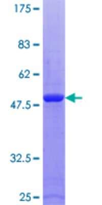 SDS-PAGE: Recombinant Human RAB9A GST (N-Term) Protein [H00009367-P01]