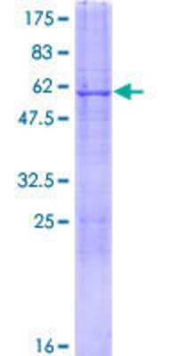 SDS-PAGE: Recombinant Human CDYL GST (N-Term) Protein [H00009425-P01]