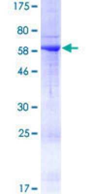 SDS-PAGE: Recombinant Human RAB36 GST (N-Term) Protein [H00009609-P01]