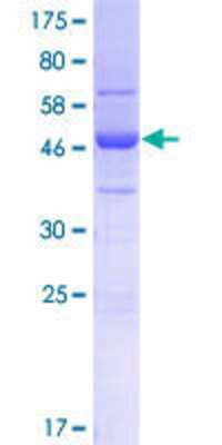SDS-PAGE: Recombinant Human SFI1 GST (N-Term) Protein [H00009814-P01]