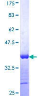 SDS-PAGE: Recombinant Human NDP52 GST (N-Term) Protein [H00010241-Q01]