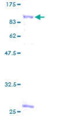 SDS-PAGE: Recombinant Human STAM2 GST (N-Term) Protein [H00010254-P01]